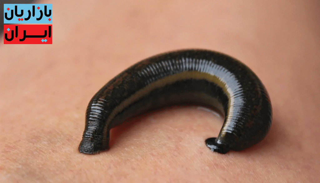 فروش انواع زالو در سایزهای مختلف در کرج